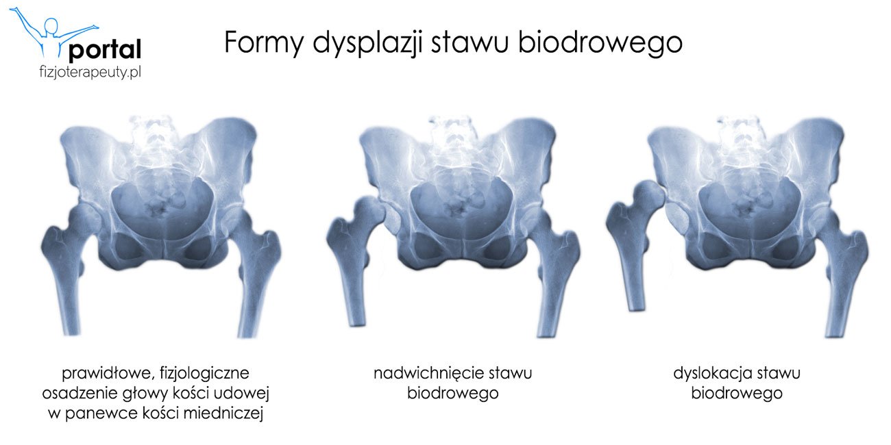 chusteczki nawilżane dada z pokrywka