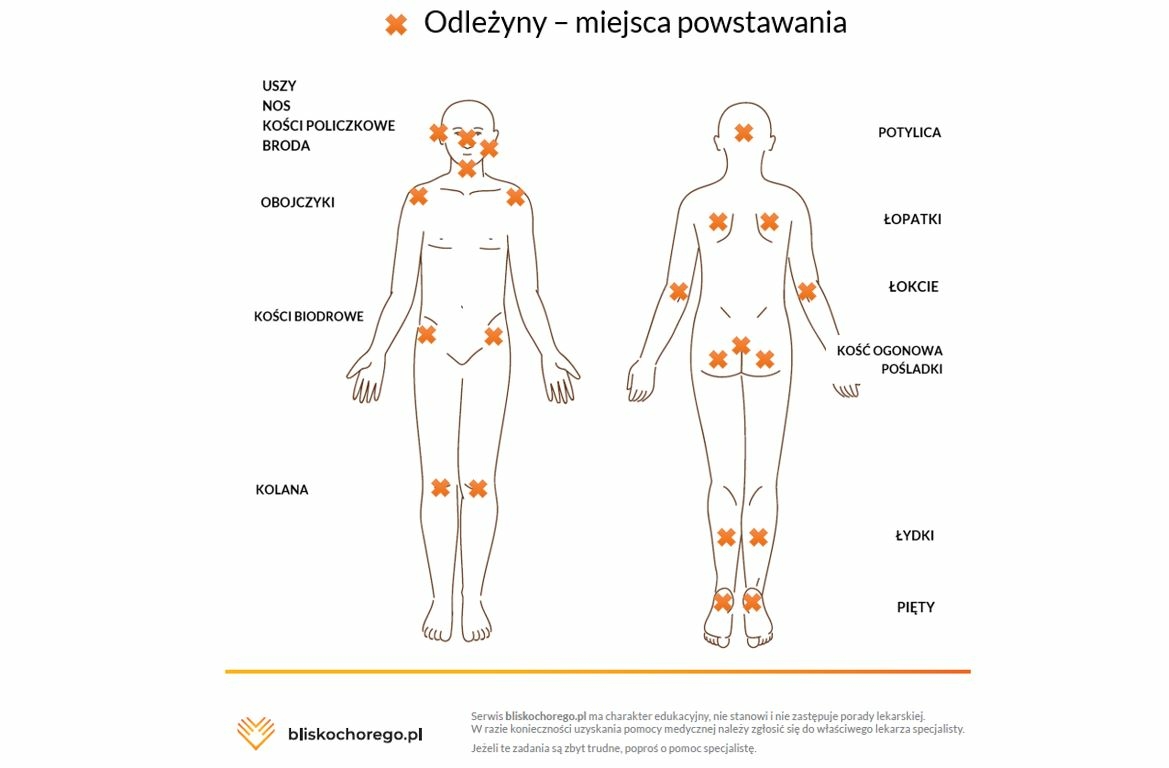 zlecenie na pieluchomajtki potwierdzenie